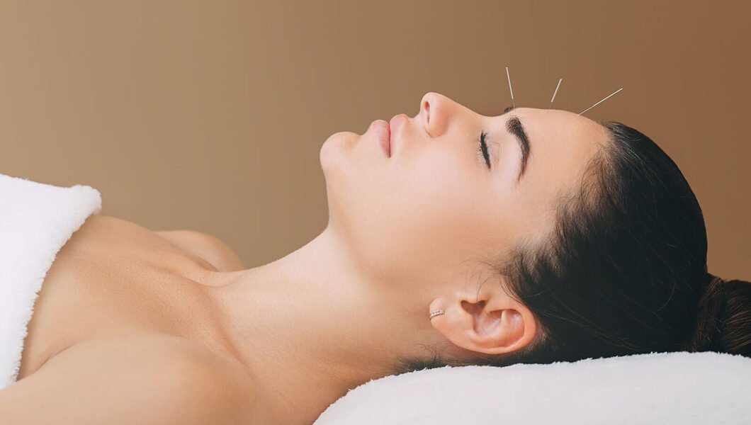 acupuncture in Cambridge