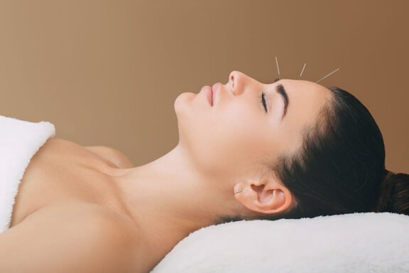 acupuncture in Cambridge